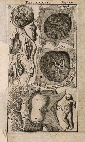 view A foetus and placenta with umbilical cord. Engraving, 1686, the second, third, fifth and sixth figures after G. de Lairesse, 1685.