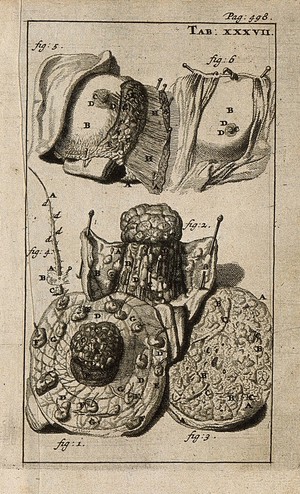 view The breast dissected and the nipple and areola and a hair as viewed under a microscope. Engraving, 1686.