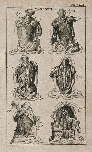 view Muscles of the back and abdomen. Engraving, 1686, after Gérard de Lairesse, 1685.