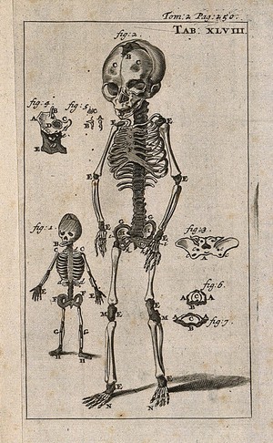 view The skeletons of two foetuses, two and five months old, demonstrating the development of ossification. Engraving, 1686.