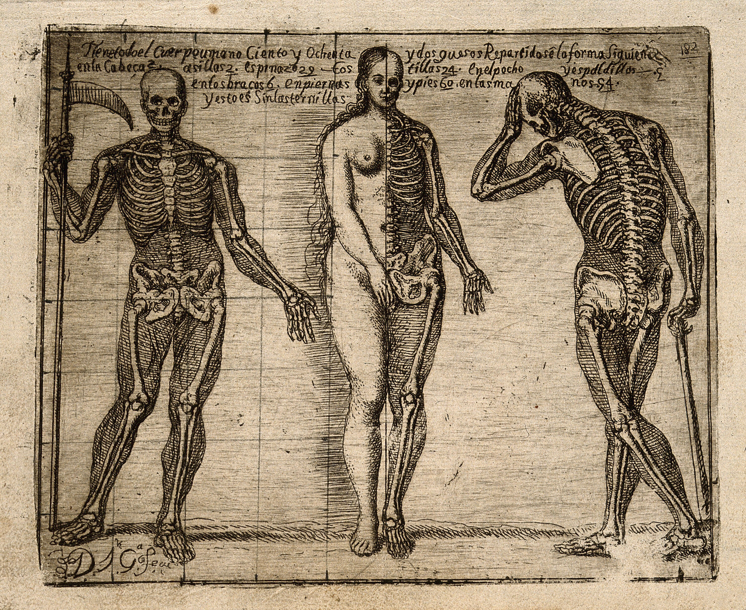 Two Skeletons And One Half Skeleton Half Female Figure All The Bones Depicted With The Exception Of The Skulls Have Indications In Shading Of The Contours Of The Overlying Body Etching By J G