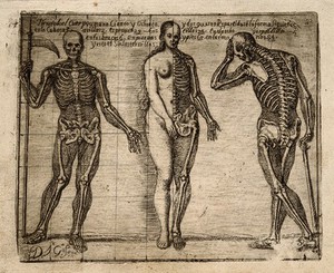 Two Skeletons And One Half Skeleton Half Female Figure With Contours Of The Overlying Body Etching By J G Hidalgo Ca 1691 Wellcome Collection