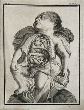 A child born with the viscera reversed. Engraving, 1749.