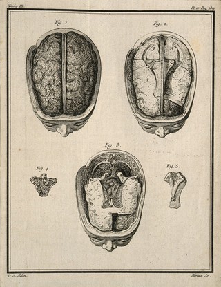 A wax model of the brain made by F. La Croix after dissections by G. J. Duverney. Engraving by P.E. Moitte after J. de Sève, 1749.