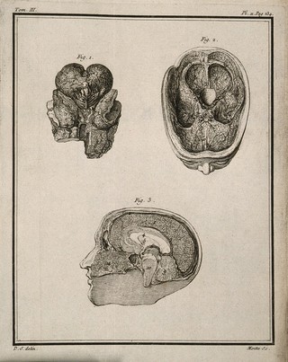 A wax model of the brain and head (figs 1-2) by F. La Croix after G. Duverney and a wax model of a section of the brain made by Russel, "chirurgien major des Gardes-du-corp" (fig. 3) Engraving by Moitte after J. de Sève, 1749.