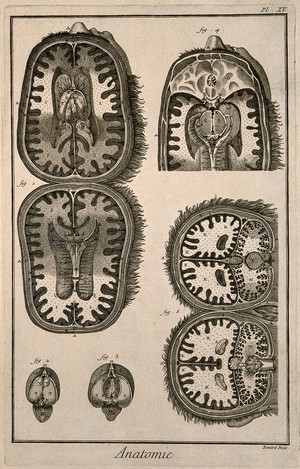 view Coronal and sagittal sections of the brain, after Tarin. Engraving by Benard, late 18th century.