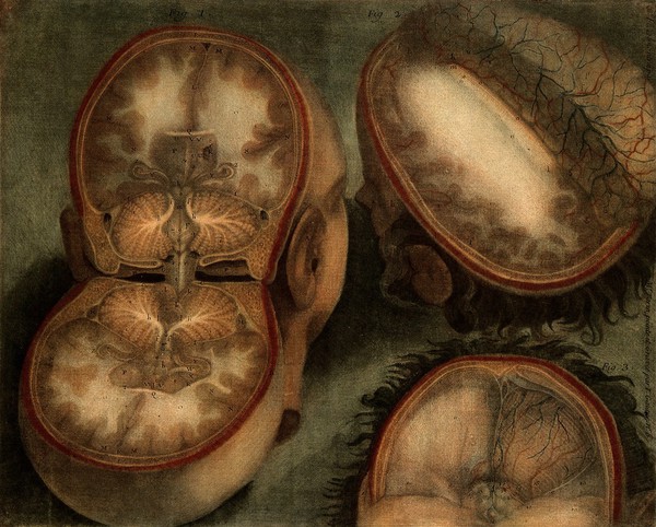 The brain: three dissections. Colour mezzotint by J.F. Gautier d'Agoty, 1748.