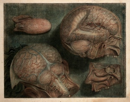Tongue, brain, nasal cavity: two dissections. Colour mezzotint by J.F. Gautier d'Agoty, 1748.