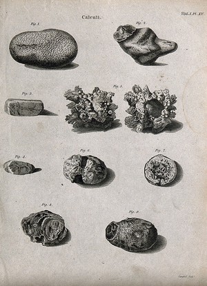 view Calculi: 9 figures. Line engraving by Campbell, 1816/1821.