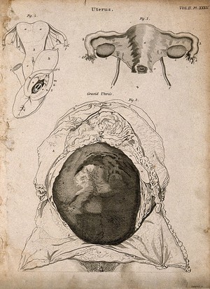 view The womb: three figures, one of the pregnant womb. Line engraving by Campbell, 1816/1821.