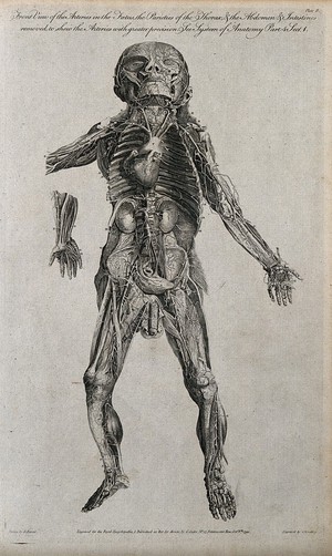 view Dissected foetus seen from the front, with arteries indicated. Line engraving, by G. Wooding after F. Birnie, 1790.