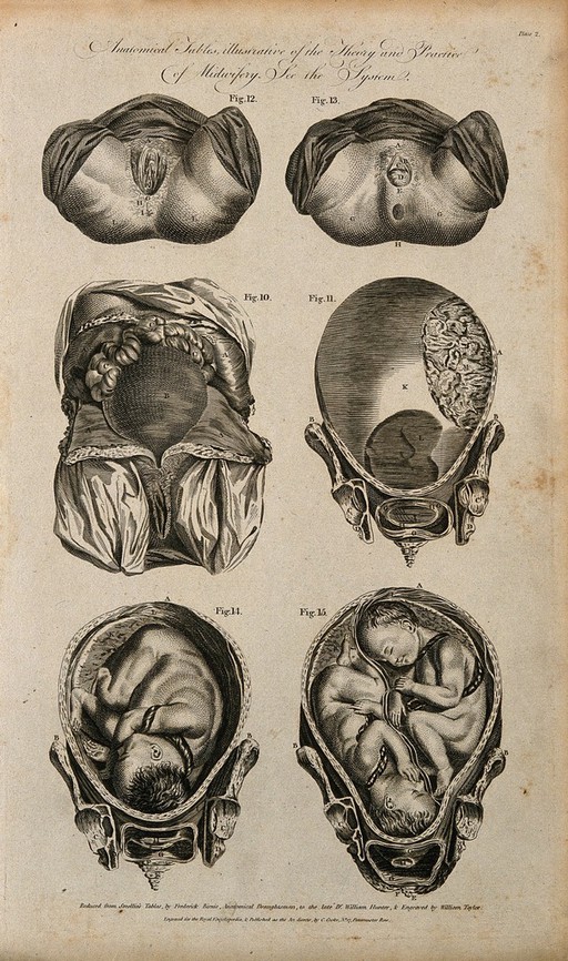 Female genitalia and uterus during pregnancy: six figures, including cross-sections of foetus and twins in utero. Line engraving, 1790(?), by W. Taylor after F. Birnie after W. Smellie.
