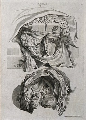 The posterior part of the brain tied with a striped ribbon (above); the back of the skull and the foramen magnum after the removal of the brain other than the cerebellum (below). Line engraving by A. Bell after G. Bidloo, 1798.