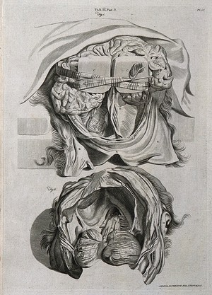 view The posterior part of the brain tied with a striped ribbon (above); the back of the skull and the foramen magnum after the removal of the brain other than the cerebellum (below). Line engraving by A. Bell after G. Bidloo, 1798.