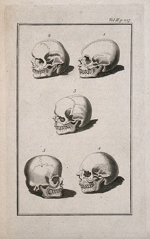 view Human skulls showing sutures: five figures. Line engraving, 1780/1800?.