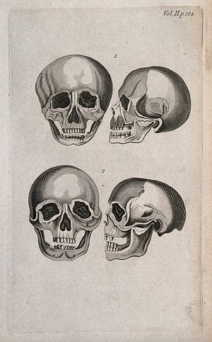 view Human skulls: four figures. Line engraving, 1780/1800?.
