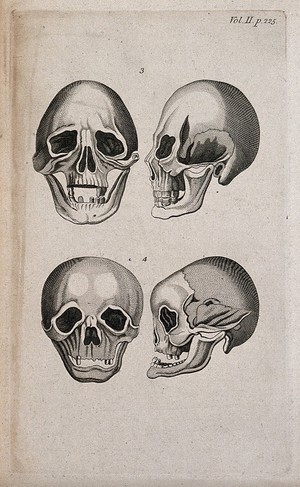 view Human skulls: four figures. Line engraving, 1780/1800?.