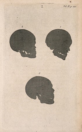 Human skulls in silhouette: four figures. Line engraving, 1780/1800?.