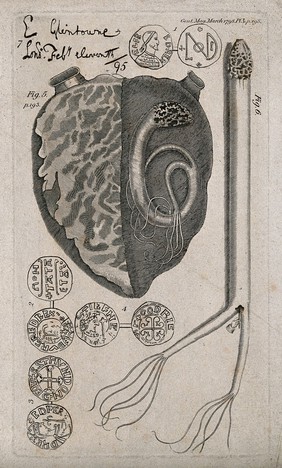 Heart with a snake-like polyp in the left ventricle: five figures including detail of the polyp and ancient coins(?). Line engraving after E. May, 1798.