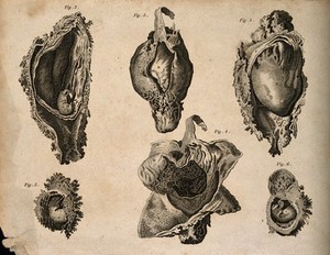 view Foetus in utero: six figures. Stipple engraving by Campbell(?), after W. Hunter(?), 1816/1821.