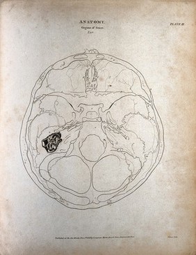 The human ear: the anatomy of the inner ear, as seen through above and through the skull. Engraving by T. Milton, 1808.