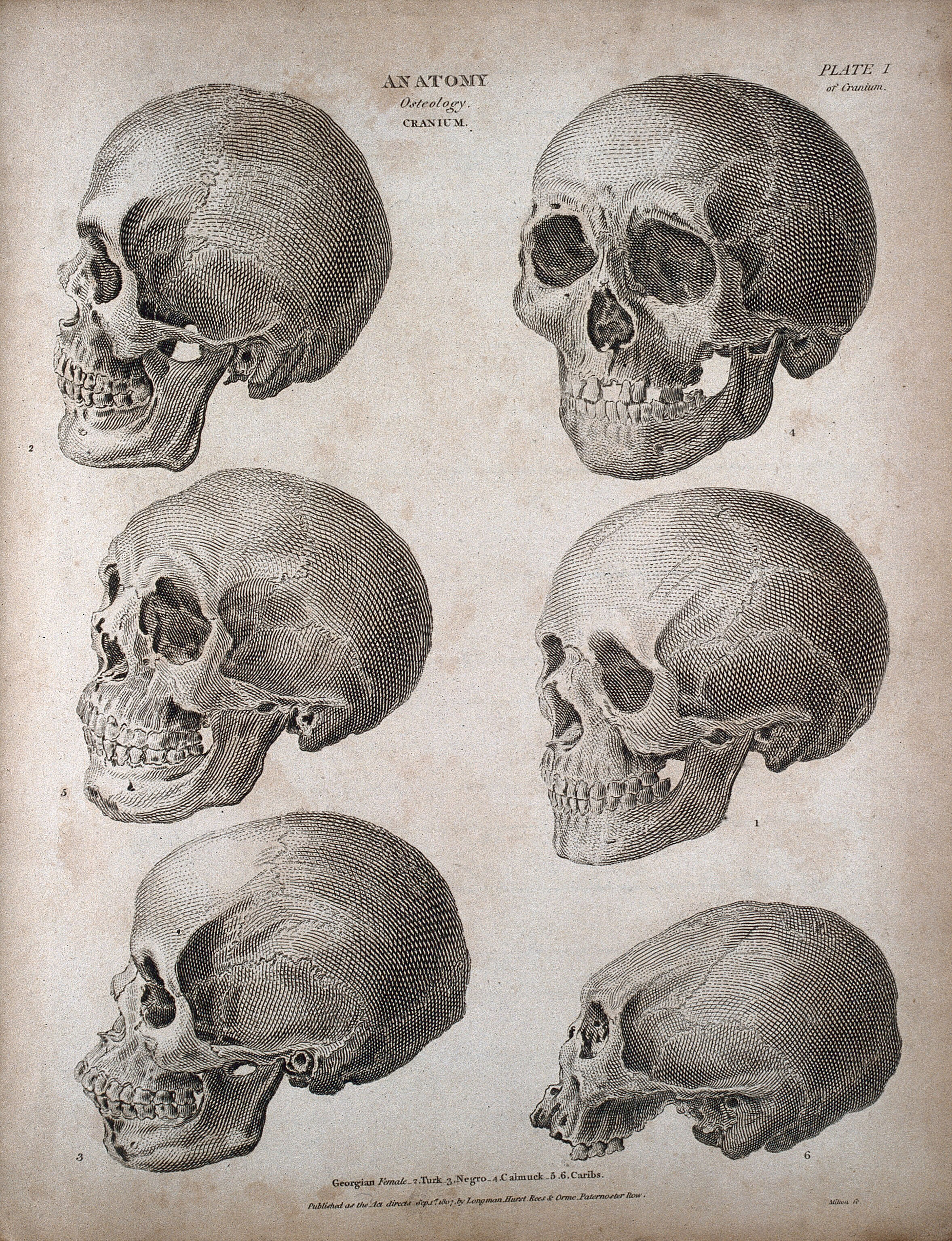 the skulls