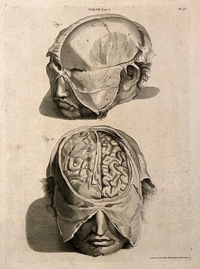 The head of a man with a moustache and beard: above, with some of the skin removed; below, showing part of the brain. Line engraving by A. Bell after G. Bidloo, 1798.