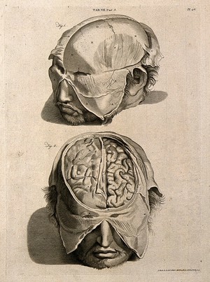 view The head of a man with a moustache and beard: above, with some of the skin removed; below, showing part of the brain. Line engraving by A. Bell after G. Bidloo, 1798.