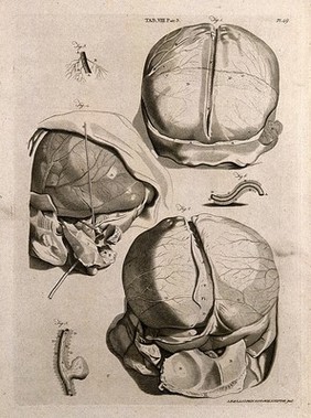 The head of a man with the meninges around the brain exposed. Line engraving by A. Bell after G. Bidloo, 1798.