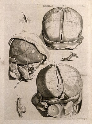 view The head of a man with the meninges around the brain exposed. Line engraving by A. Bell after G. Bidloo, 1798.