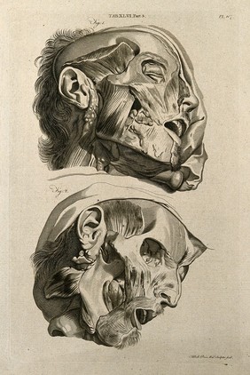 Muscles of the head: two figures. Line engraving by A. Bell after G. Bidloo, 1798.