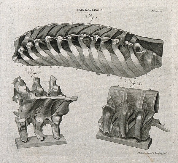 Ligaments attached to the ribs (above) and to the vertebrae (below): three figures. Line engraving by A. Bell after J. Weitbrecht, 1798.
