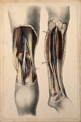 Popliteal arteries: two figures showing dissections of the leg. Coloured lithograph by G.E. Madeley after A. A. Cane, 1834.