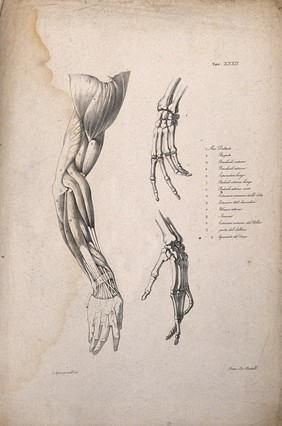 Muscles and bones of the shoulder, arm and hand: an écorché arm and two figures of the bones of the hand. Lithograph by Martelli after C. Squanquerillo, ca. 1839.