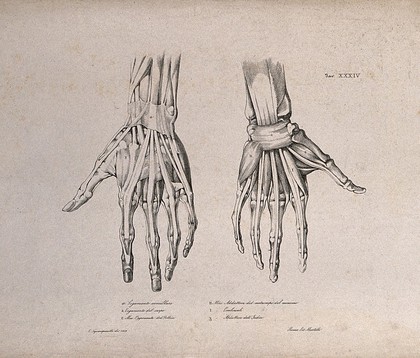 Muscles and ligaments of the hand: two figures of écorché hands. Lithograph by Martelli after C. Squanquerillo, 1839.