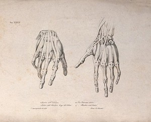 view Muscles and ligaments of the hand: two figures of écorché hands. Lithograph by Martelli after C. Squanquerillo, 1839.