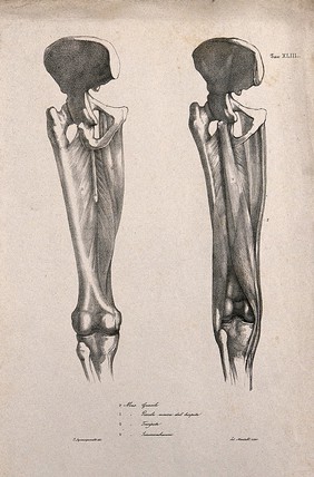 Muscles and bones of the upper leg and pelvis: two figures. Lithograph by Martelli after C. Squanquerillo, 1840.