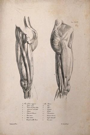 view Muscles and bones of the upper leg and pelvis: two figures. Lithograph by Martelli after C. Squanquerillo, 1840.