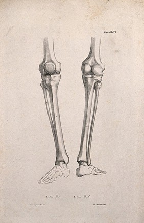 Bones of the foot and lower leg: two figures. Lithograph by Martelli after C. Squanquerillo, 1840.