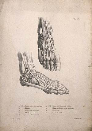 view Muscles and tendons of the feet: two figures. Lithograph by Martelli after C. Squanquerillo, 1840.