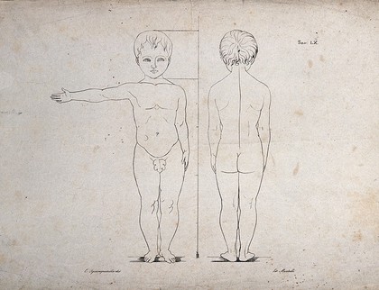 Proportions of a male child's body: front and back view of a nude child, with proportions marked. Lithograph by Martelli after Squanquerillo, ca. 1840.