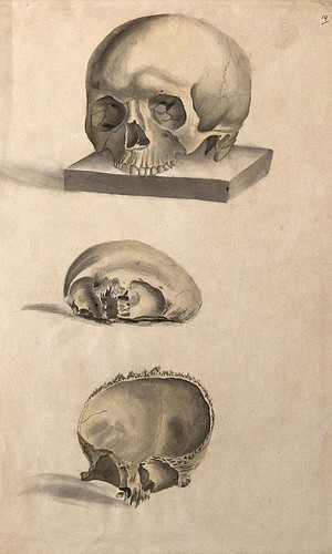 view Human skull: three figures showing sections and an entire skull. Ink and watercolour, 1830/1835?, after W. Cheselden, ca. 1733.