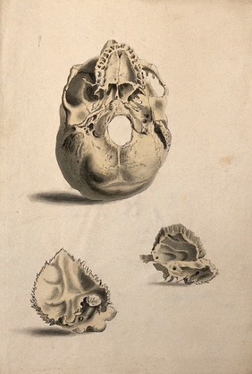 Human skull: three figures showing sections and an entire skull. Ink and watercolour, 1830/1835?, after W. Cheselden, ca. 1733.