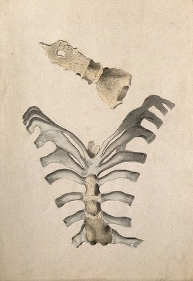 Ribs and sternum: two figures. Ink and watercolour, 1830/1835?, after W. Cheselden, ca. 1733.