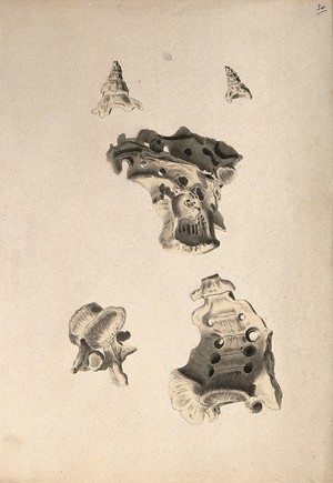 view Sacrum: five figures. Ink and watercolour, 1830/1835?, after W. Cheselden, ca. 1733.