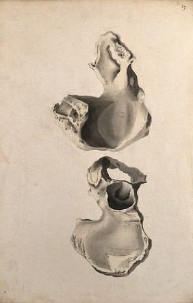 Hip bones: two figures. Ink and watercolour, 1830/1835?, after W. Cheselden, ca. 1733.