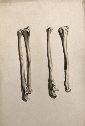 Radius and ulna bones: two figures. Ink and watercolour, 1830/1835?, after W. Cheselden, ca. 1733.