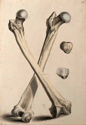 view Crossed femurs (thigh-bones). Ink and watercolour, 1830/1835?, after W. Cheselden, ca. 1733.