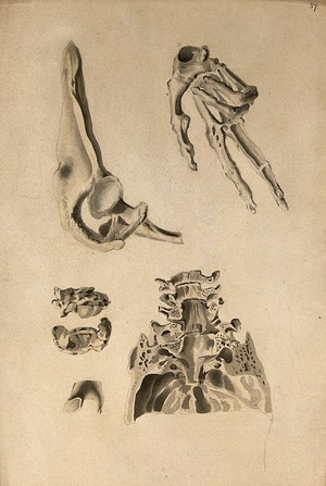 view Bones: four figures of various bones. Ink and watercolour, 1830/1835?, after W. Cheselden, ca. 1733.