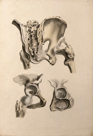 view Ligaments of hip-bone and femur (thigh-bone). Ink and watercolour, 1830/1835?, after W. Cheselden, ca. 1733.